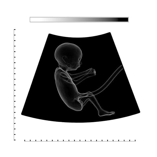 Jak se ujistit, že je placenta po porodu úplně odstraněna